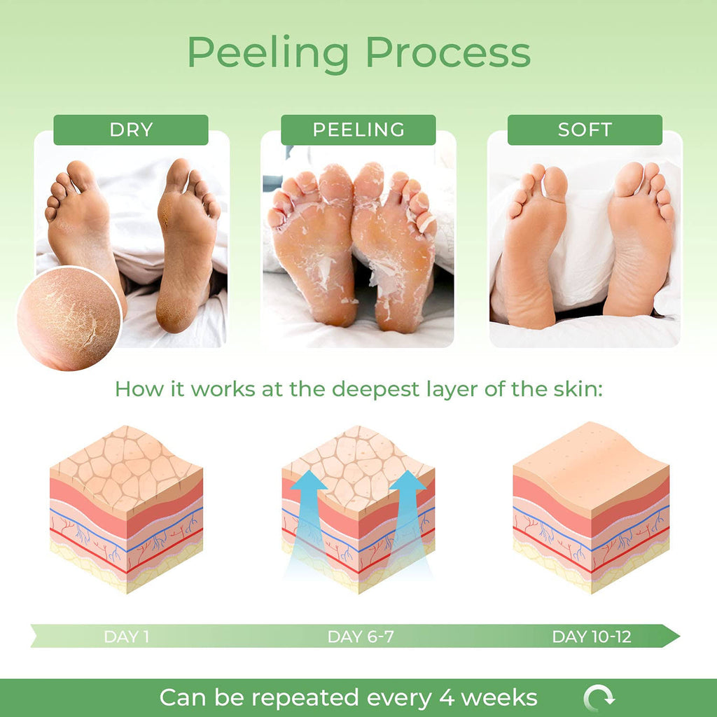 Dermatologist Tested Foot Exfoliator Peeling Scrub R7348